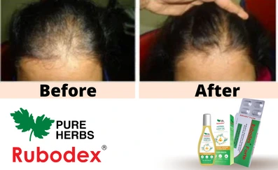 rubodex hair oil results
