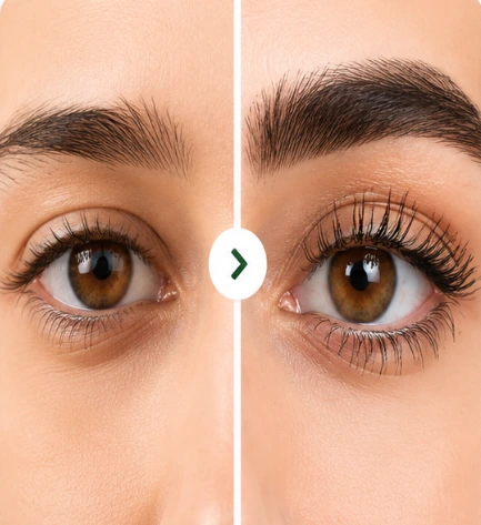 Eyelash Growth Transformation
